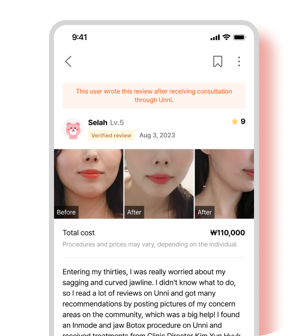 unni review